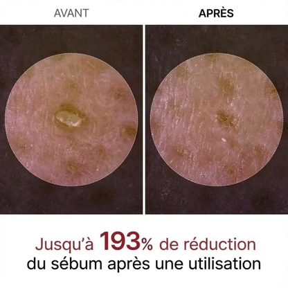 Soleillya™ Peel Shot – Esfoliante Delicato AHA/BHA al Riso