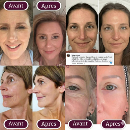 Soleillya™ Stift Kollagen-Calcium